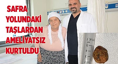 74 yaşındaki hasta safra yolundaki taşlardan ameliyatsız kurtuldu