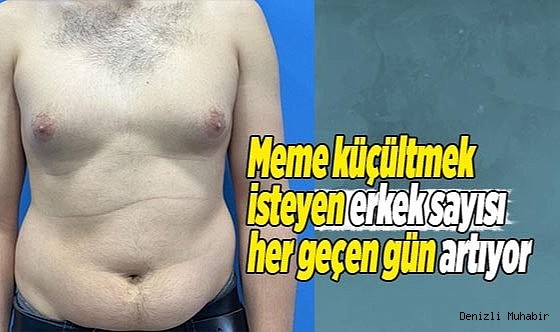 Meme küçültmek isteyen erkek sayısı her geçen gün artıyor