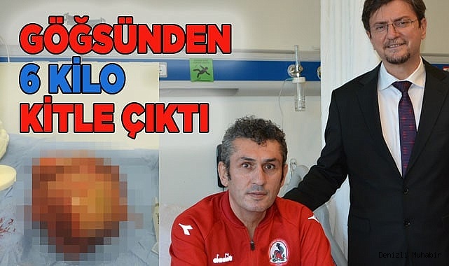 Göğsünden 6 kilo kitle çıktı