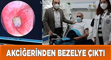 Akciğerde Beklenmedik Görüntü: Bezelye Başarıyla Çıkartıldı