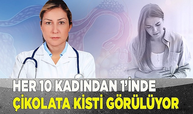 Her 10 kadından 1’inde çikolata kisti görülüyor