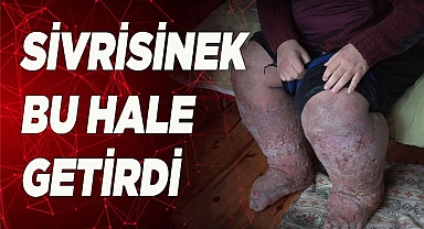 Sivrisinek, güvenlik görevlisinin hayatını kararttı