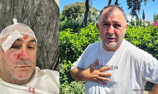 Spor yorumcusu ve işletmeci Levent Bulut öldüresiye dövülüp gasp edildi