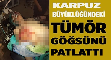 Tümör göğsünü patlattı