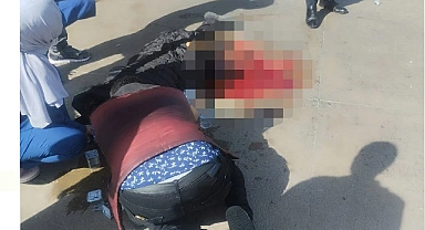 Otobüsün altında kalan hamile kadının bacağı koptu
