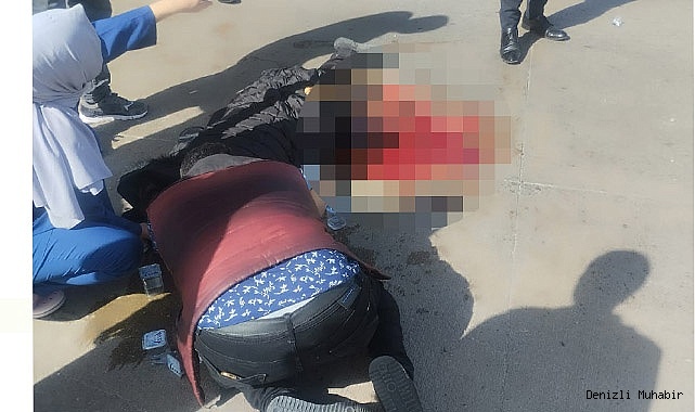 Otobüsün altında kalan hamile kadının bacağı koptu