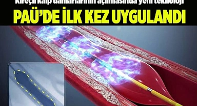 Kireçli kalp damarlarının açılmasında yeni teknoloji