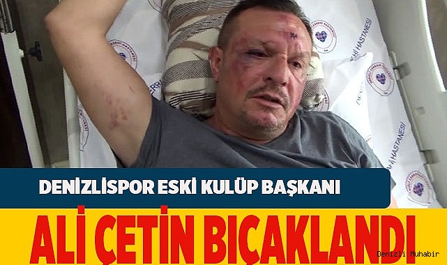 Denizlispor'un eski Başkanı bıçaklı kavgada yaralandı