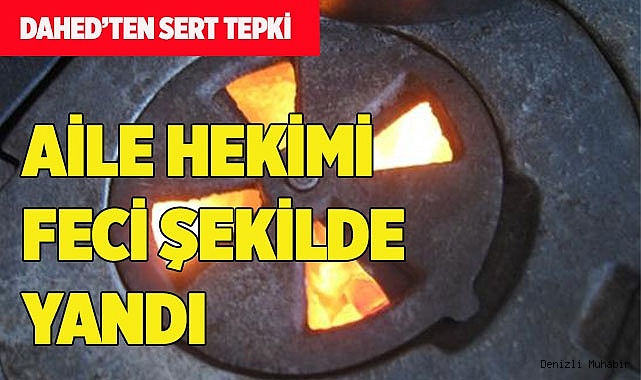 AİLE HEKİMİ FECİ ŞEKİLDE YANDI