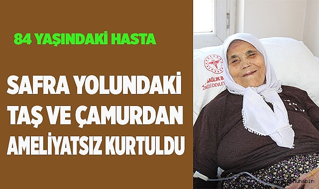Safra yolundaki taş ve çamurdan ameliyatsız kurtuldu