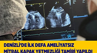 Denizli’de ilk defa ameliyatsız mitral kapak yetmezliği tamiri yapıldı