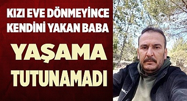 Kendisini yakan baba hayatını kaybetti