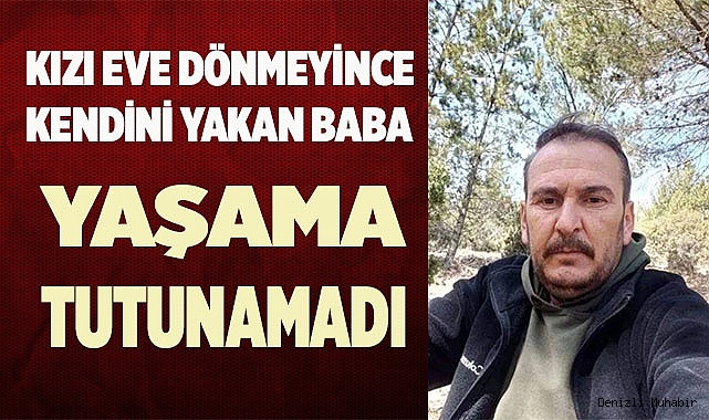 Kendisini yakan baba hayatını kaybetti