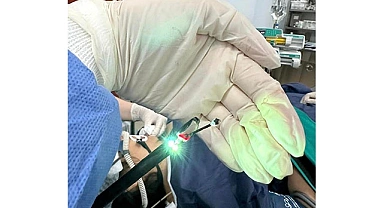 Kriyobiyopsi Yöntemini Uygulayan Türkiye’deki İkinci Merkez PAÜ Hastaneleri Oldu