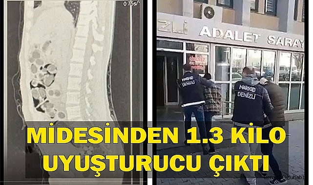 Uçaktan inen yabancı kuryenin midesinden 1.3 kilo uyuşturucu çıktı