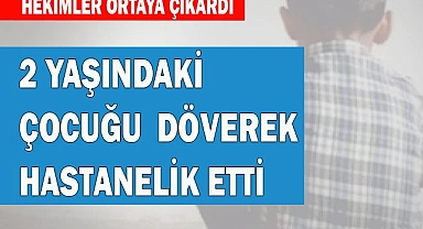 2 YAŞINDAKİ ÇOCUĞU DÖVEREK HASTANELİK ETTİ