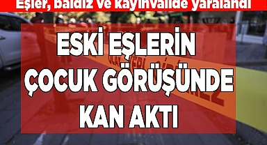 Eski eşlerin arasında çocuk görüş gününde kan aktı