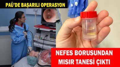 Nefes borusuna kaçan mısır tanesi çıkarıldı