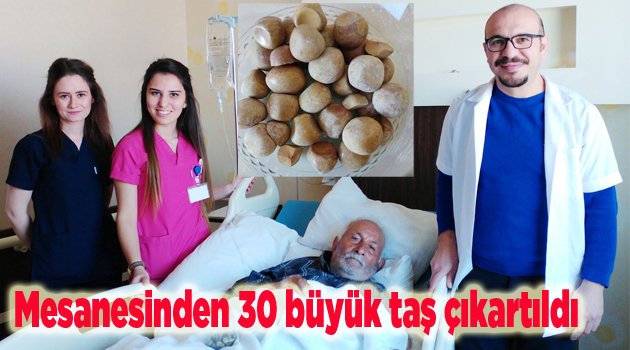 - 84 yaşındaki adamın mesanesinden 30 büyük taş çıkartıldı