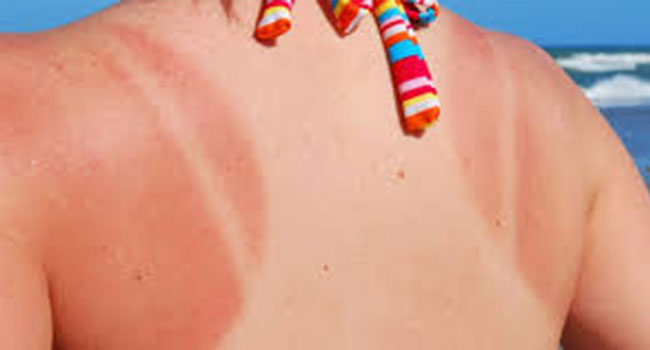 Dermatoloji Uzmanı Uyardı!