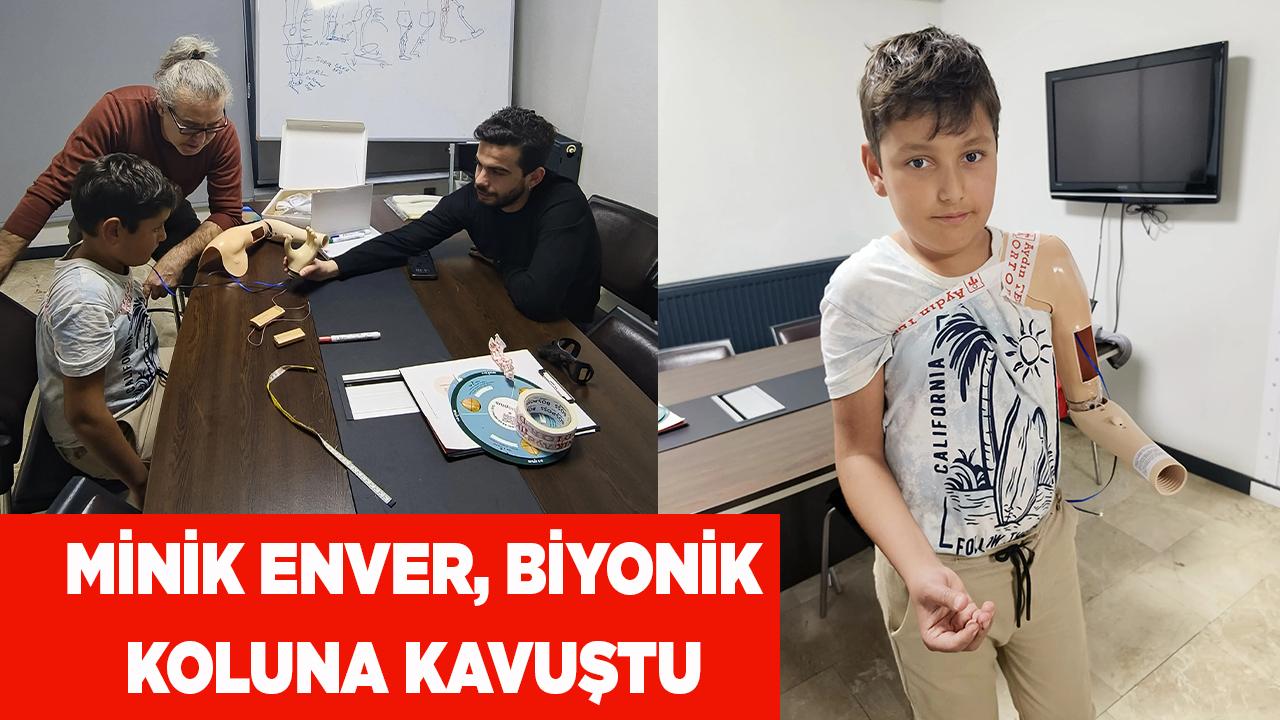 Denizli inandı, Minik Enver biyonik koluna kavuştu
