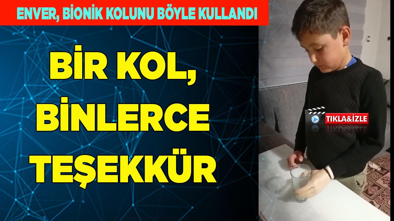 Enver İlhan biyonik kolunu böyle kullandı
