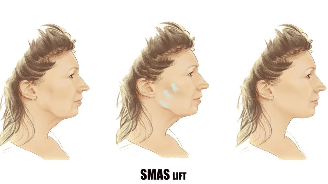 Estetik Cerrahide Nanoteknoloji Devrimi