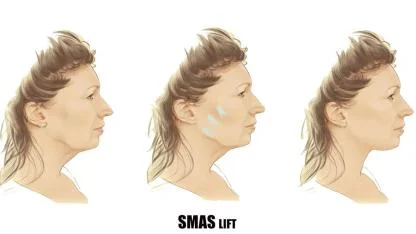 Estetik Cerrahide Nanoteknoloji Devrimi