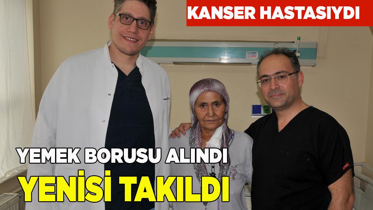 Midesinden yeni yemek borusu yapıldı