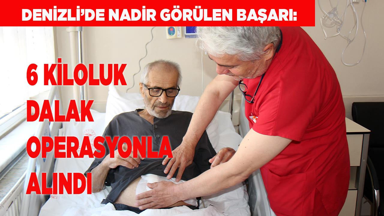 Denizli’de 6 Kiloluk Dalak Operasyonla Alındı
