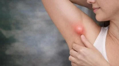 Koltuk Altındaki Şişlik Her Zaman Masum Değil