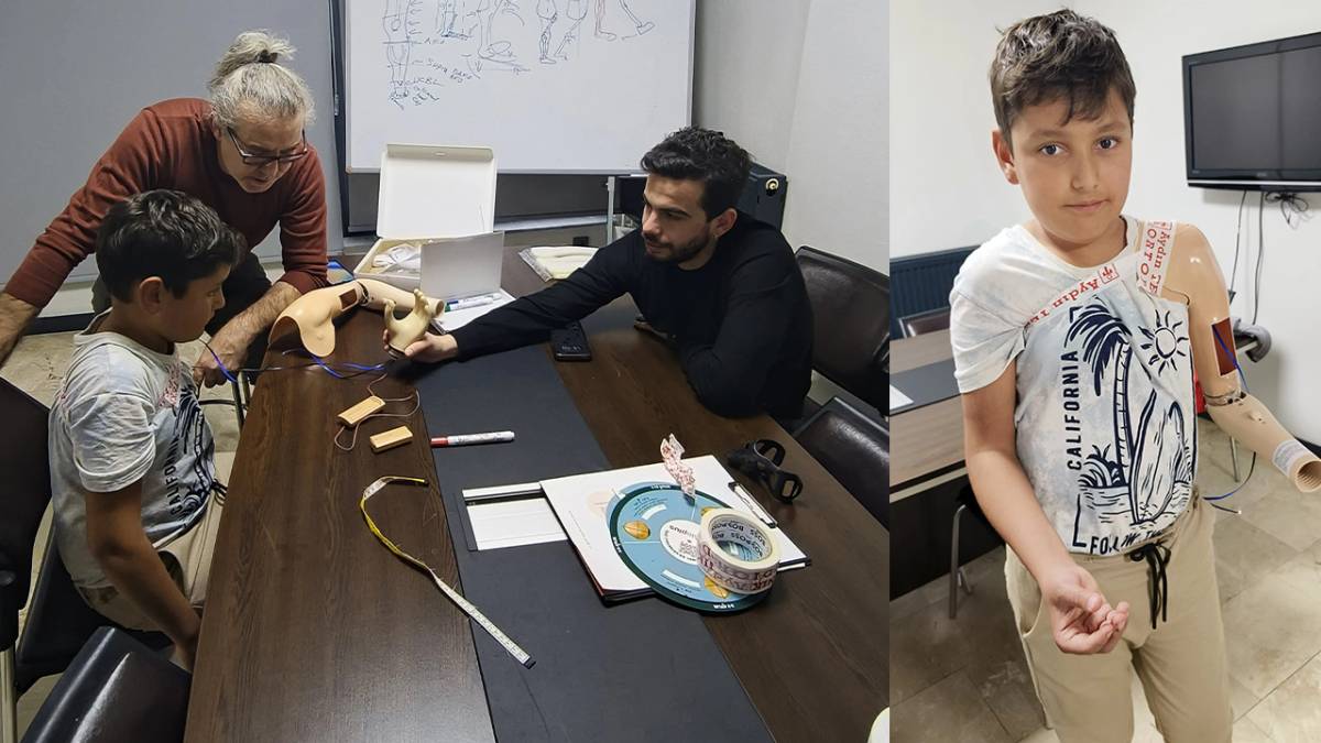 Denizli inandı, Minik Enver biyonik koluna kavuştu